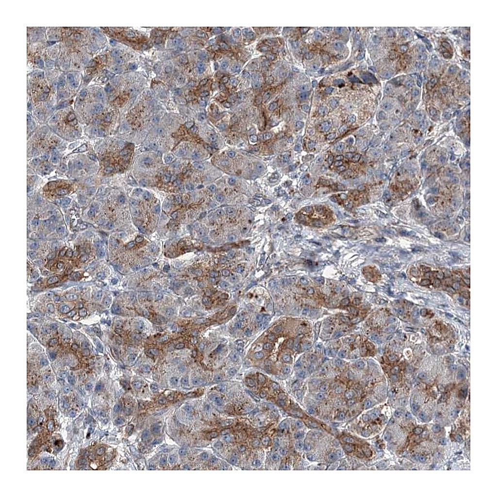 Atlas Antibodies Anti-POLR1D Antibody