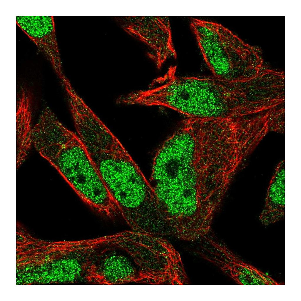 Atlas Antibodies Anti-POLN Antibody