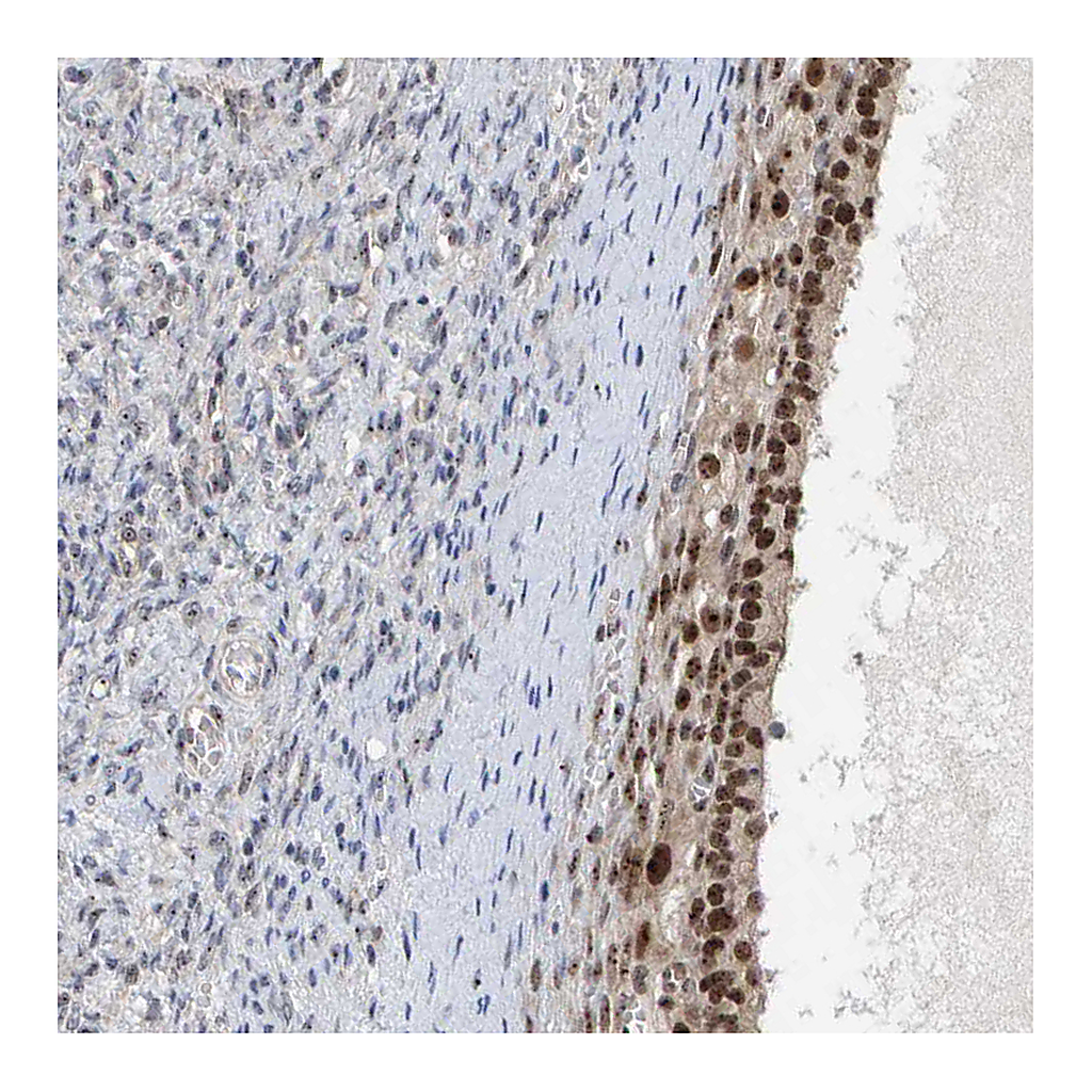 Atlas Antibodies Anti-POLR1E Antibody