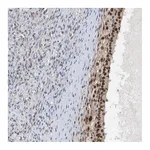 Atlas Antibodies Anti-POLR1E Antibody