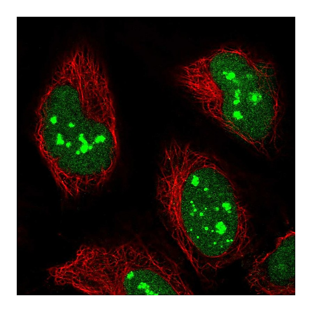 Atlas Antibodies Anti-POLR1E Antibody