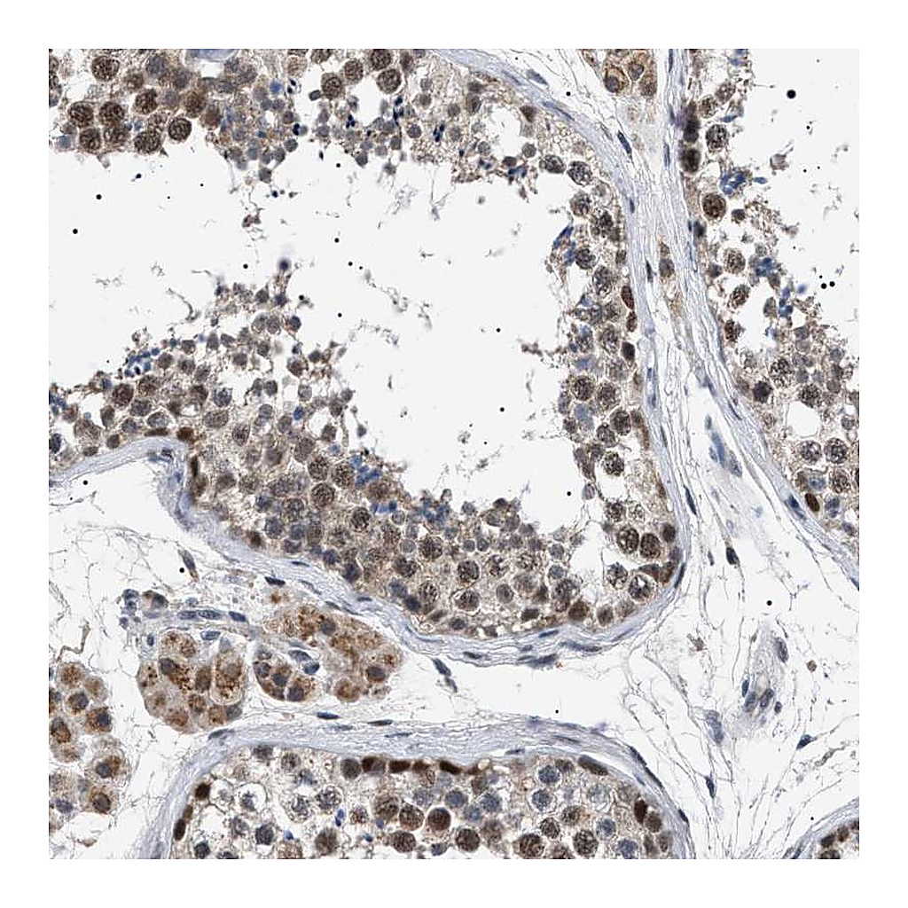 Atlas Antibodies Anti-POLR2A Antibody