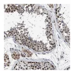 Atlas Antibodies Anti-POLR2A Antibody