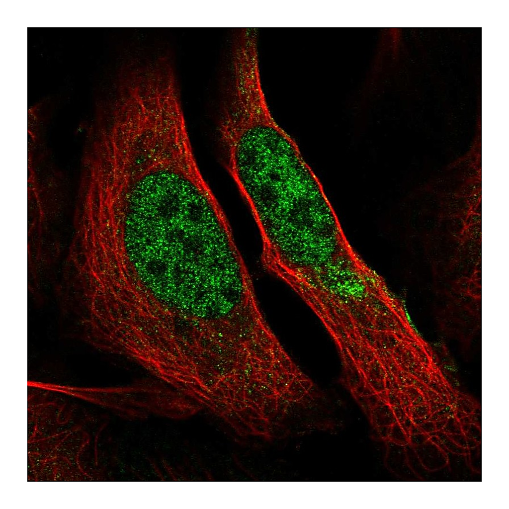 Atlas Antibodies Anti-POLR2A Antibody