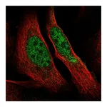 Atlas Antibodies Anti-POLR2A Antibody