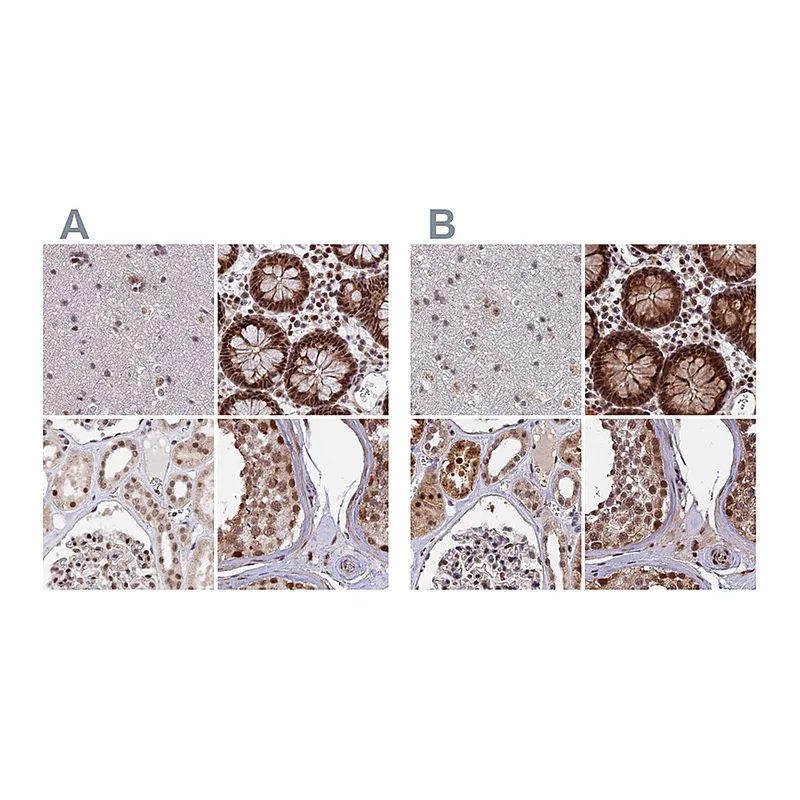 Atlas Antibodies Anti-POLR2C Antibody