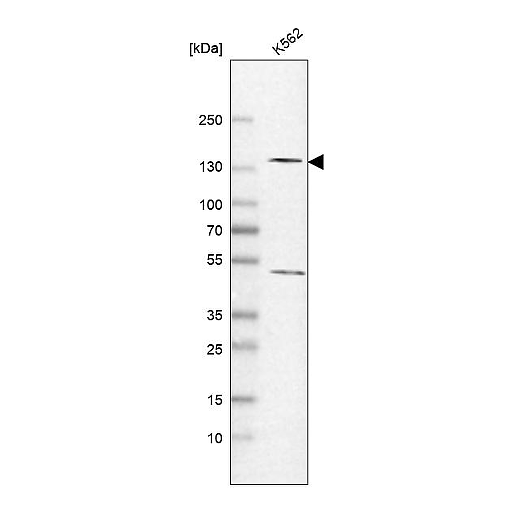 Atlas Antibodies Anti-POLR2B Antibody