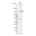 Atlas Antibodies Anti-POLR2B Antibody