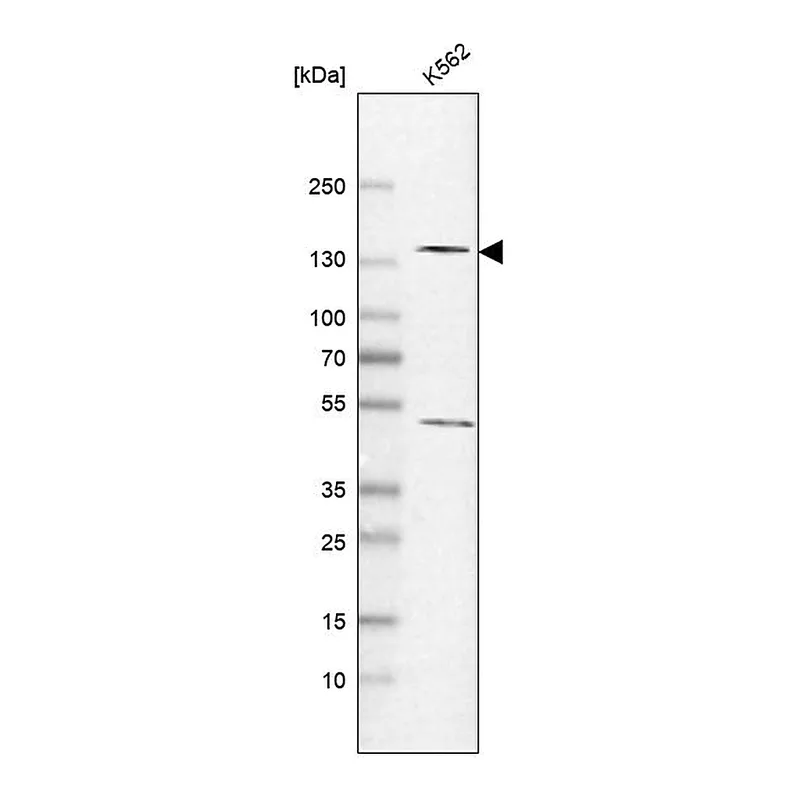 Atlas Antibodies Anti-POLR2B Antibody
