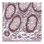 Atlas Antibodies Anti-POLR2E Antibody