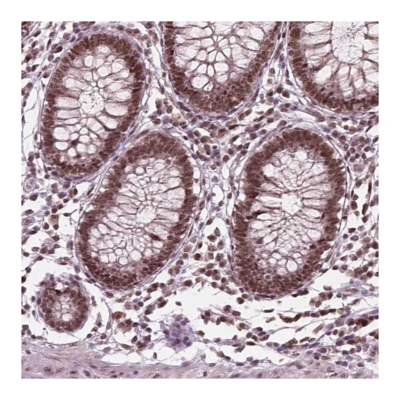 Atlas Antibodies Anti-POLR2E Antibody