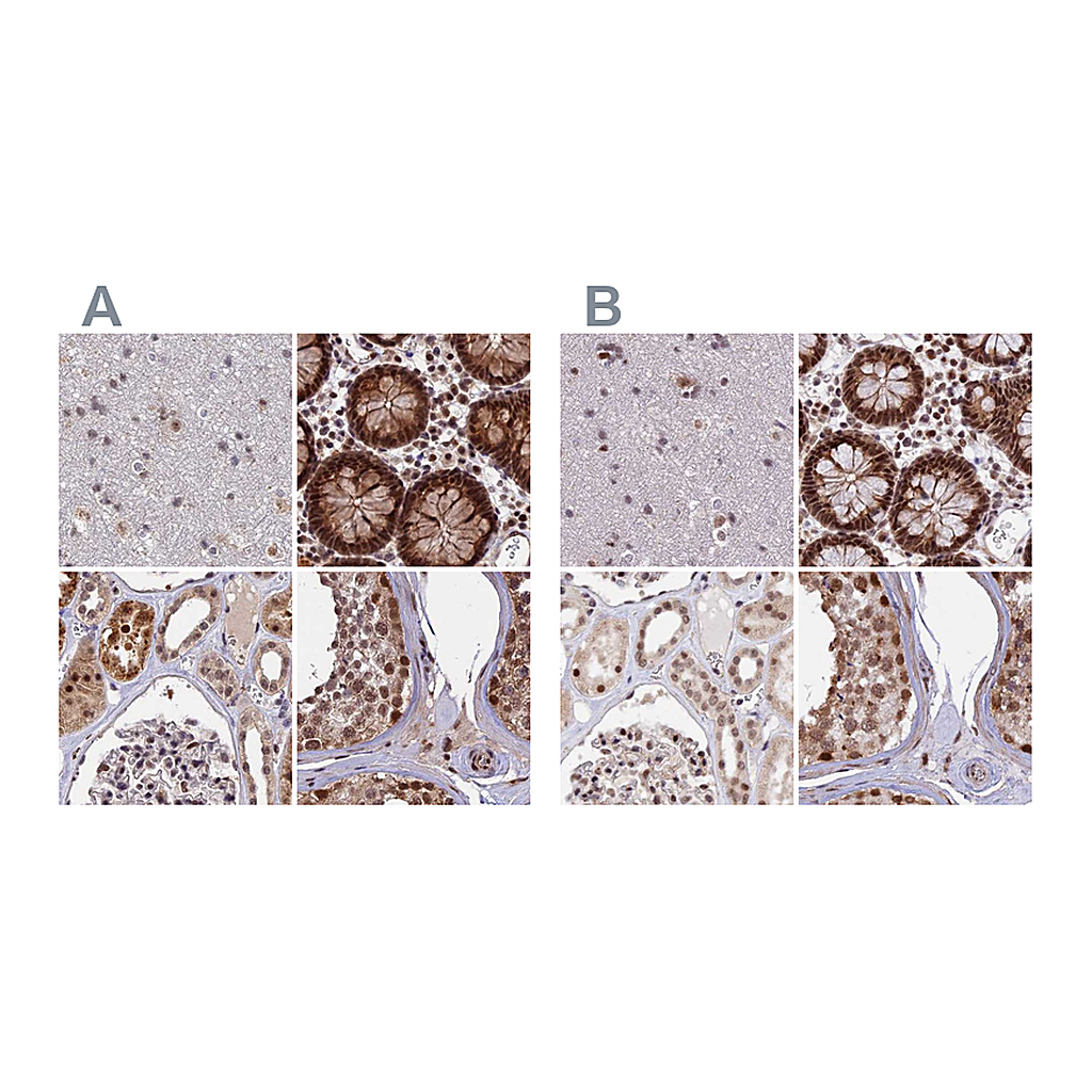 Atlas Antibodies Anti-POLR2C Antibody