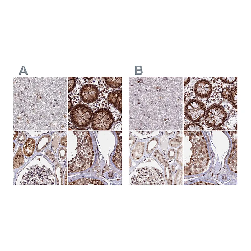 Atlas Antibodies Anti-POLR2C Antibody