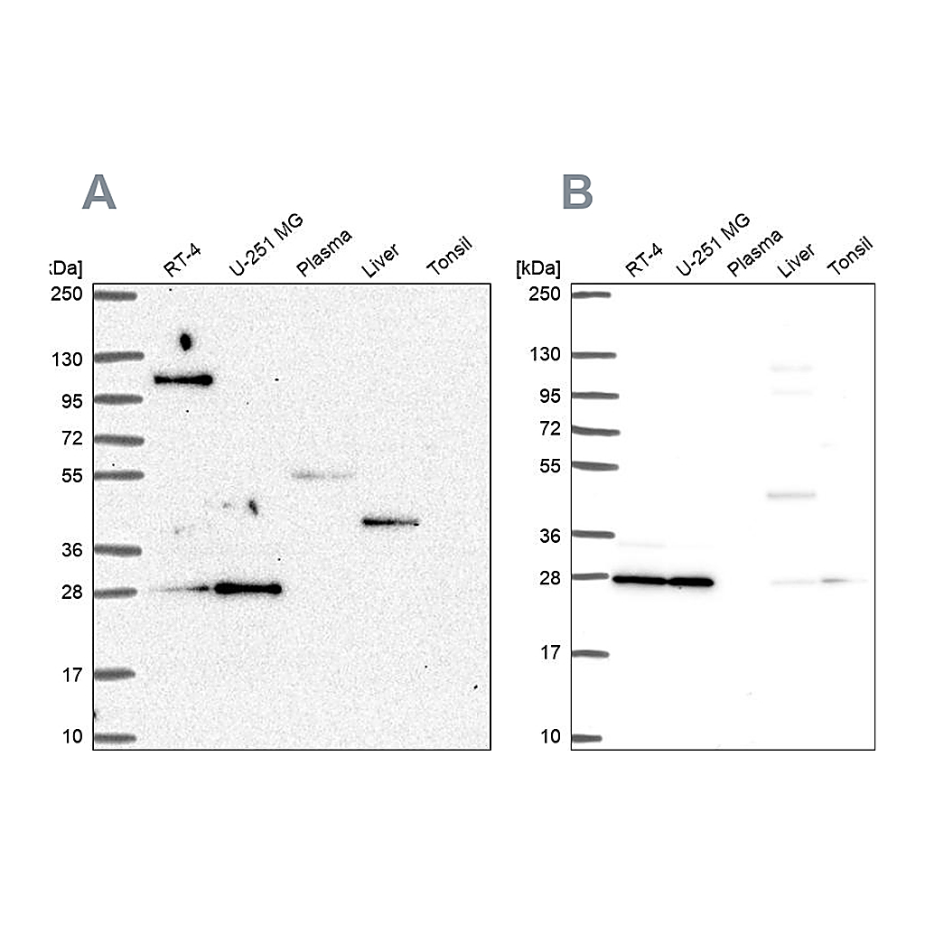 Atlas Antibodies Anti-POLR2E Antibody