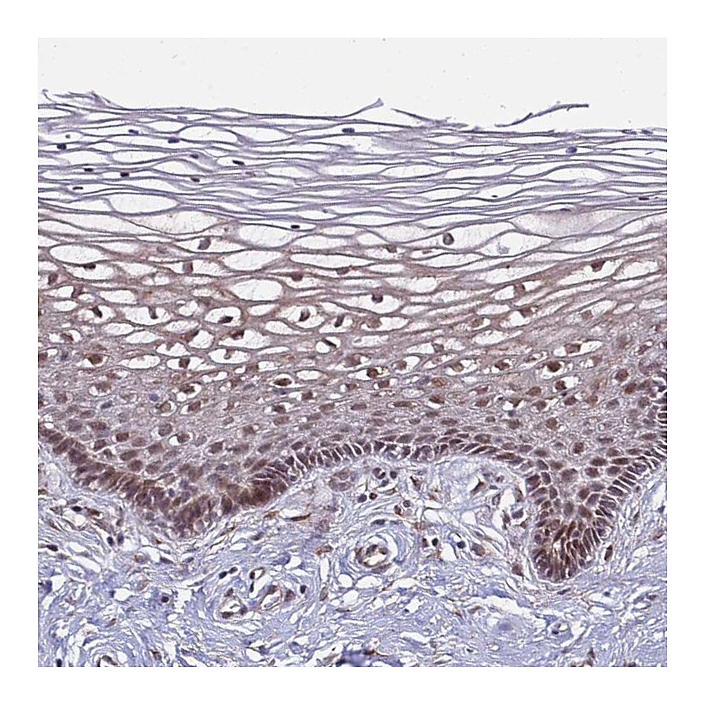 Atlas Antibodies Anti-POLR2D Antibody