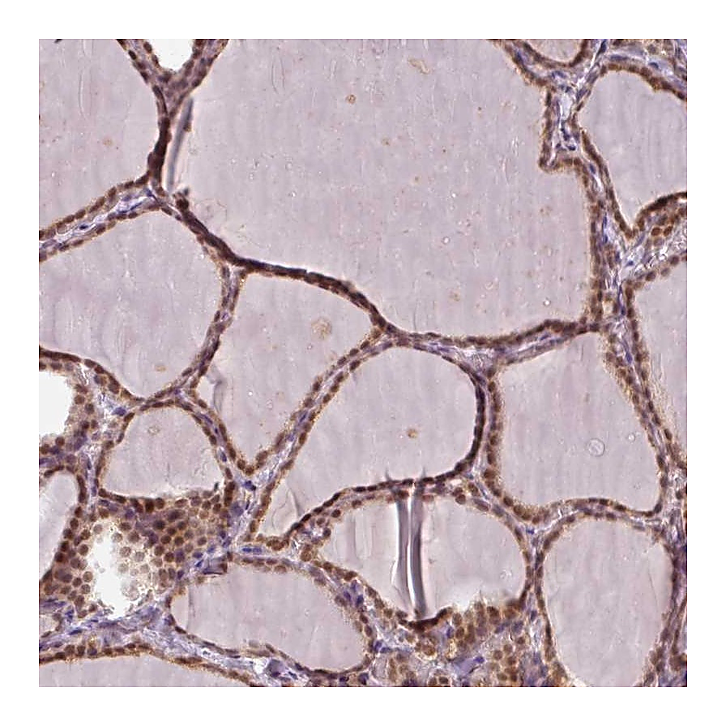 Atlas Antibodies Anti-POLR2G Antibody