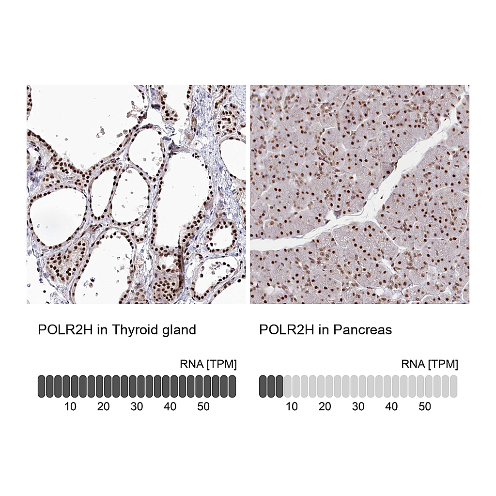Atlas Antibodies Anti-POLR2H Antibody
