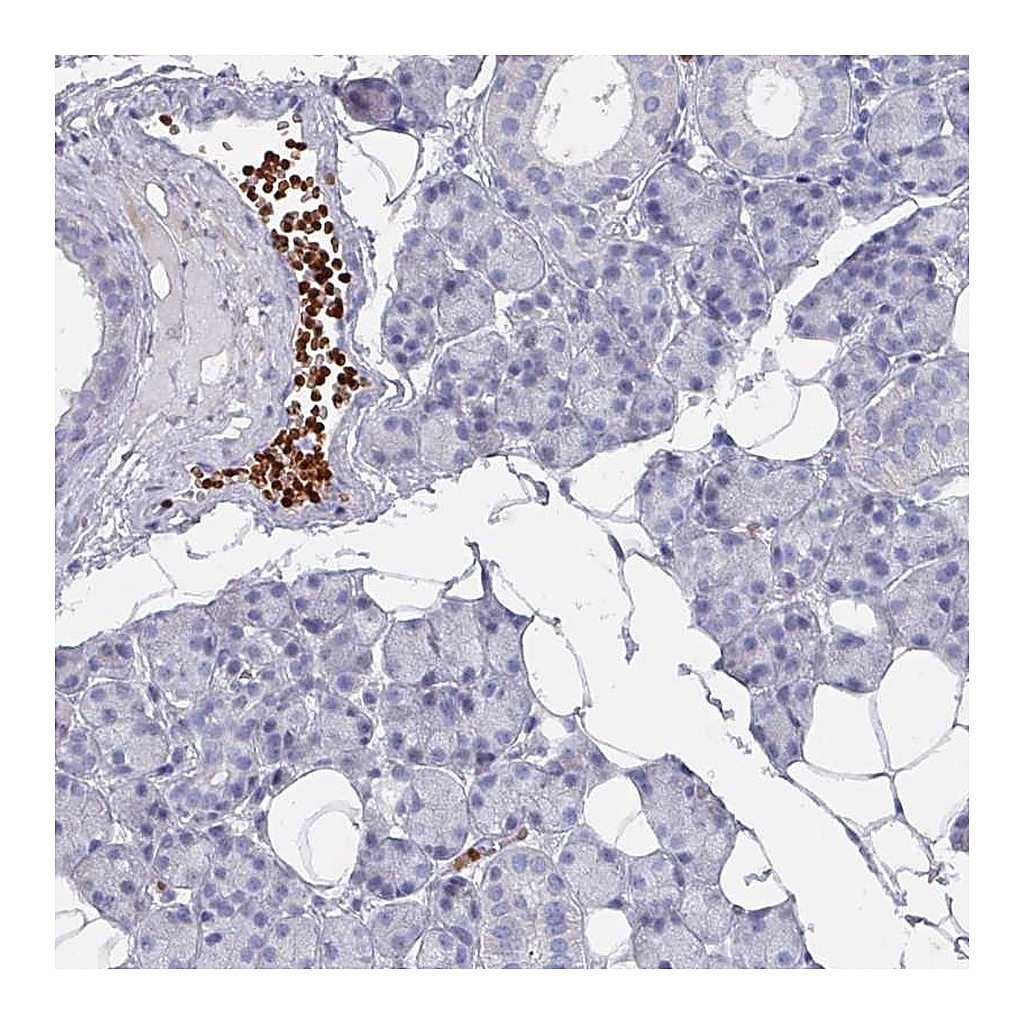 Atlas Antibodies Anti-POLR2J Antibody