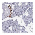 Atlas Antibodies Anti-POLR2J Antibody