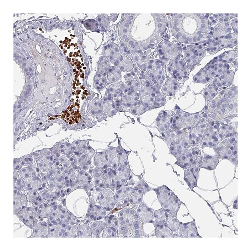 Atlas Antibodies Anti-POLR2J Antibody