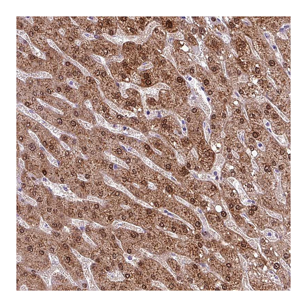 Atlas Antibodies Anti-POLR2J Antibody