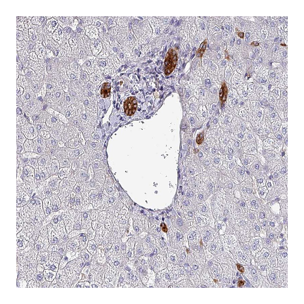 Atlas Antibodies Anti-POLR2J Antibody