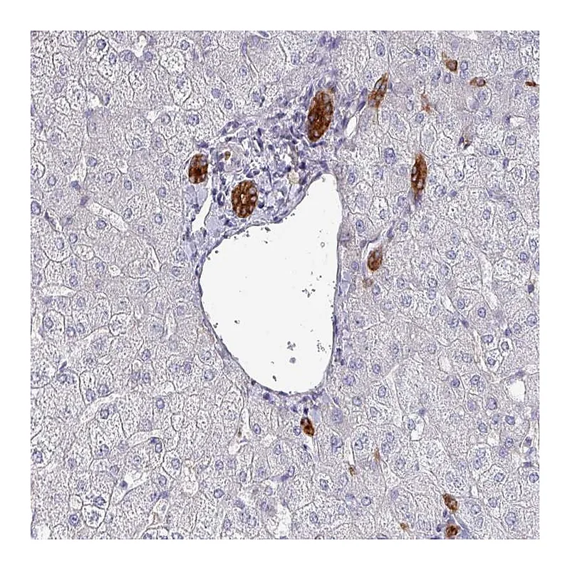 Atlas Antibodies Anti-POLR2J Antibody