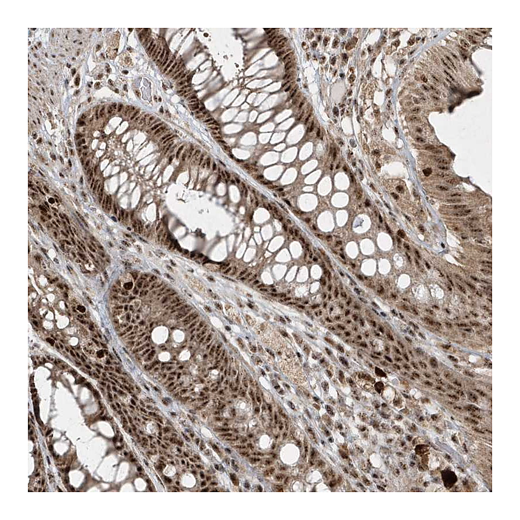 Atlas Antibodies Anti-POLR3B Antibody