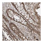 Atlas Antibodies Anti-POLR3B Antibody
