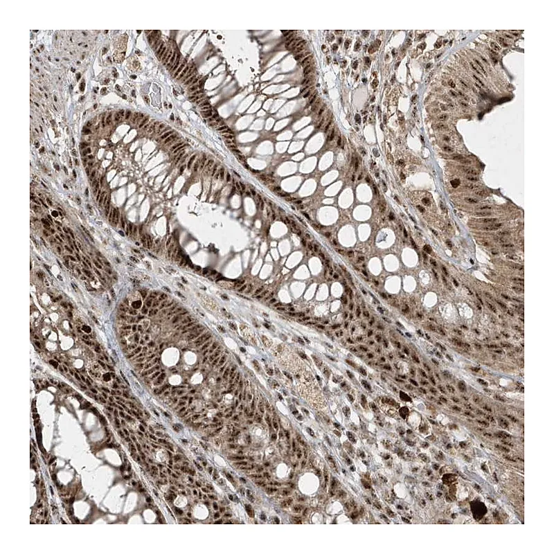 Atlas Antibodies Anti-POLR3B Antibody