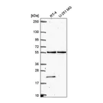 Atlas Antibodies Anti-POLR3D Antibody