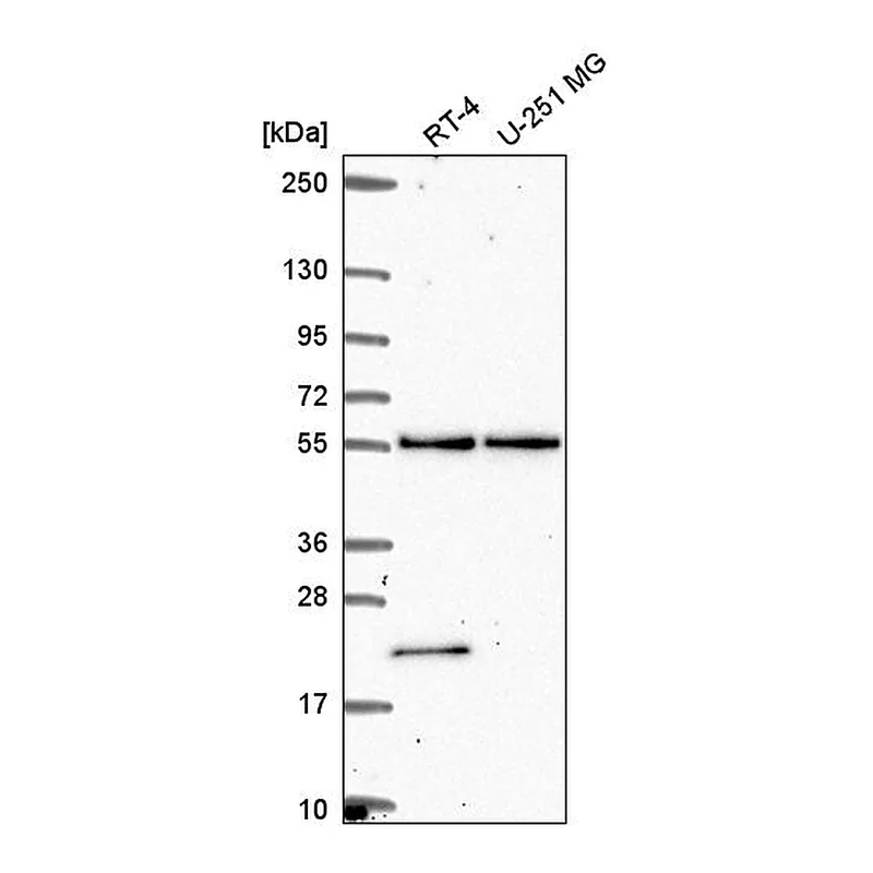 Atlas Antibodies Anti-POLR3D Antibody