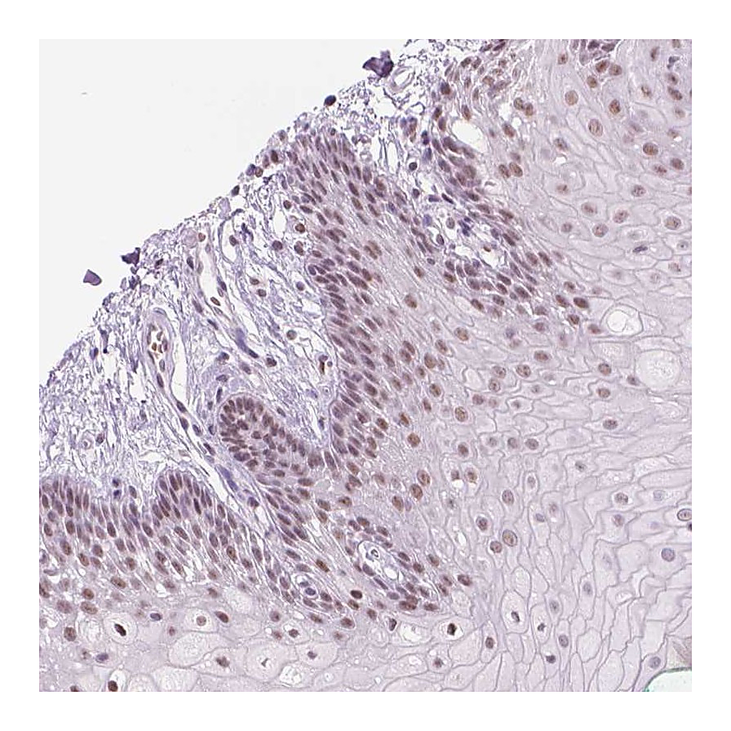 Atlas Antibodies Anti-POLR3D Antibody