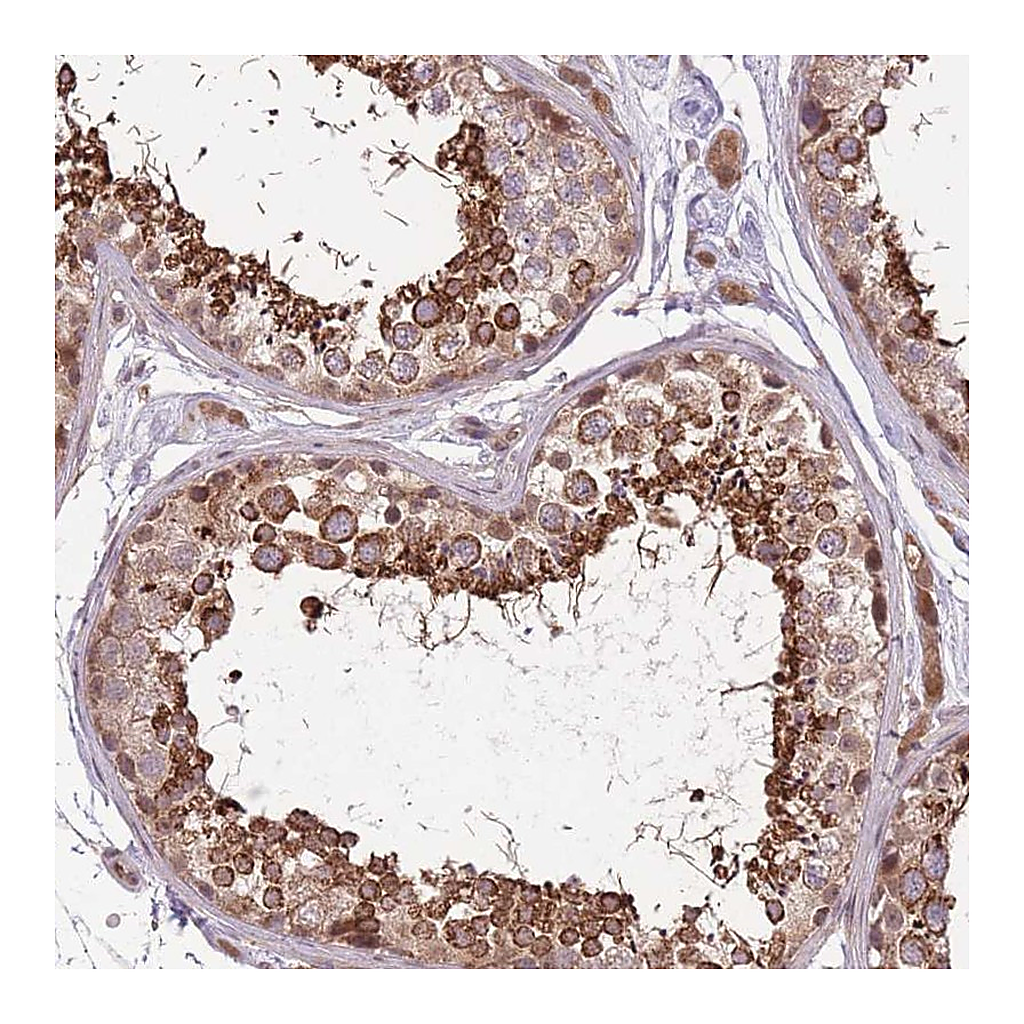 Atlas Antibodies Anti-POLR3F Antibody