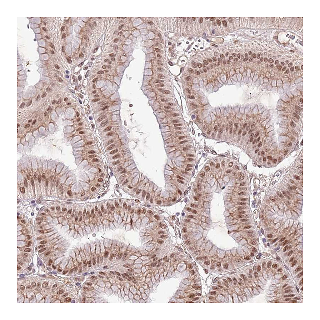 Atlas Antibodies Anti-POLR3H Antibody