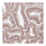 Atlas Antibodies Anti-POLR3H Antibody