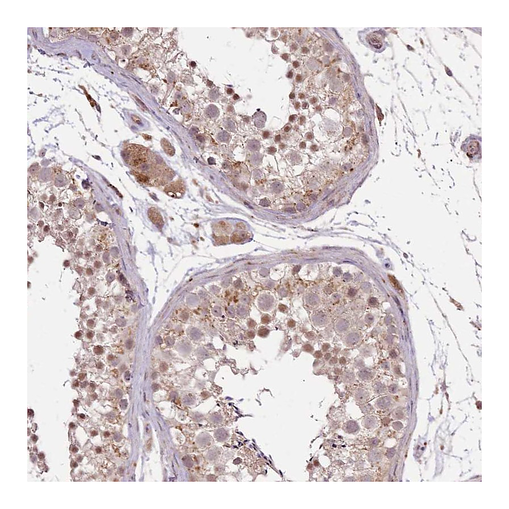 Atlas Antibodies Anti-POLR3F Antibody