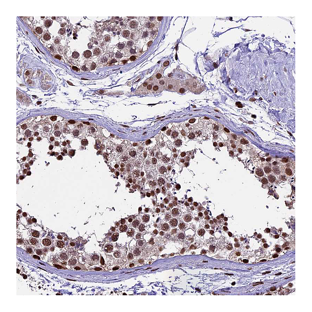 Atlas Antibodies Anti-POLR3E Antibody