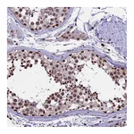 Atlas Antibodies Anti-POLR3E Antibody