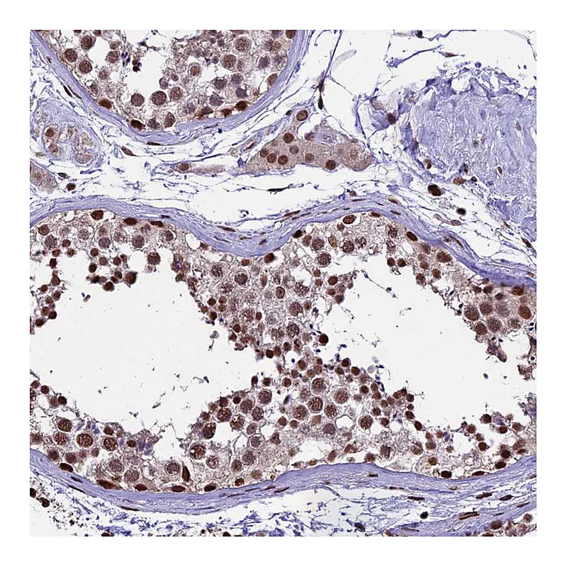 Atlas Antibodies Anti-POLR3E Antibody