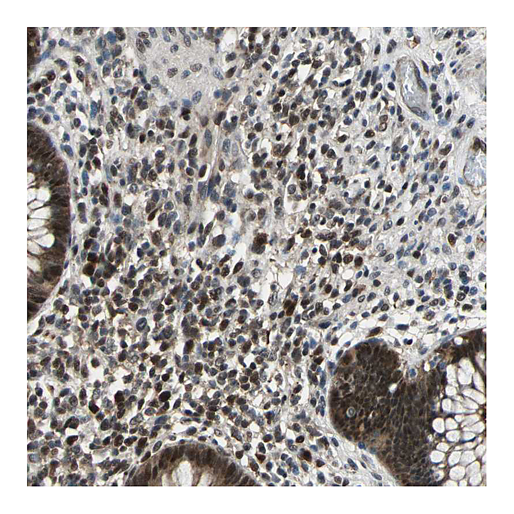 Atlas Antibodies Anti-POLR3K Antibody