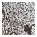 Atlas Antibodies Anti-POLR3K Antibody