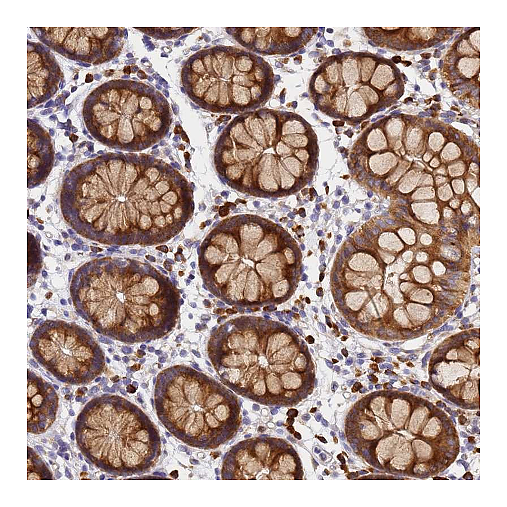 Atlas Antibodies Anti-POM121 Antibody