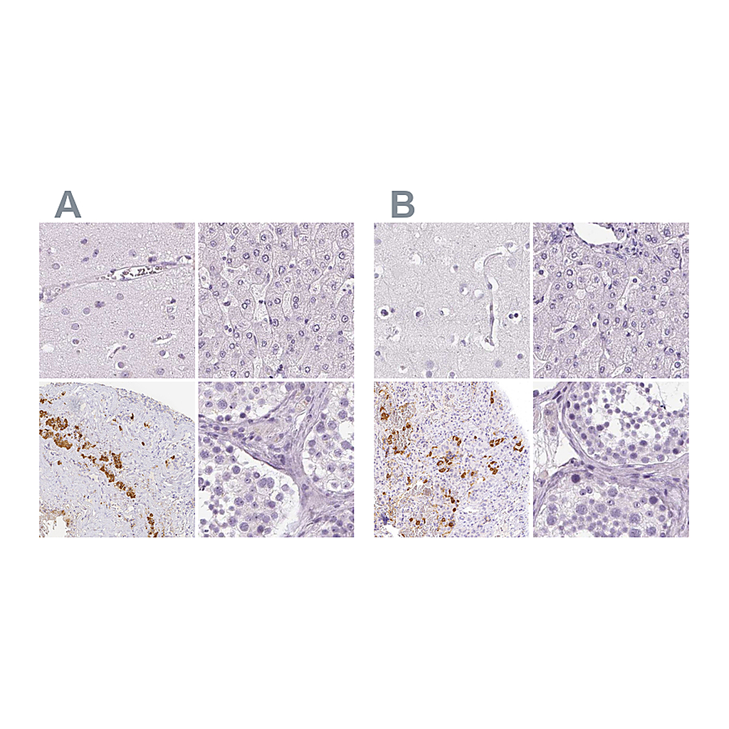 Atlas Antibodies Anti-POMC Antibody