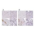 Atlas Antibodies Anti-POMC Antibody