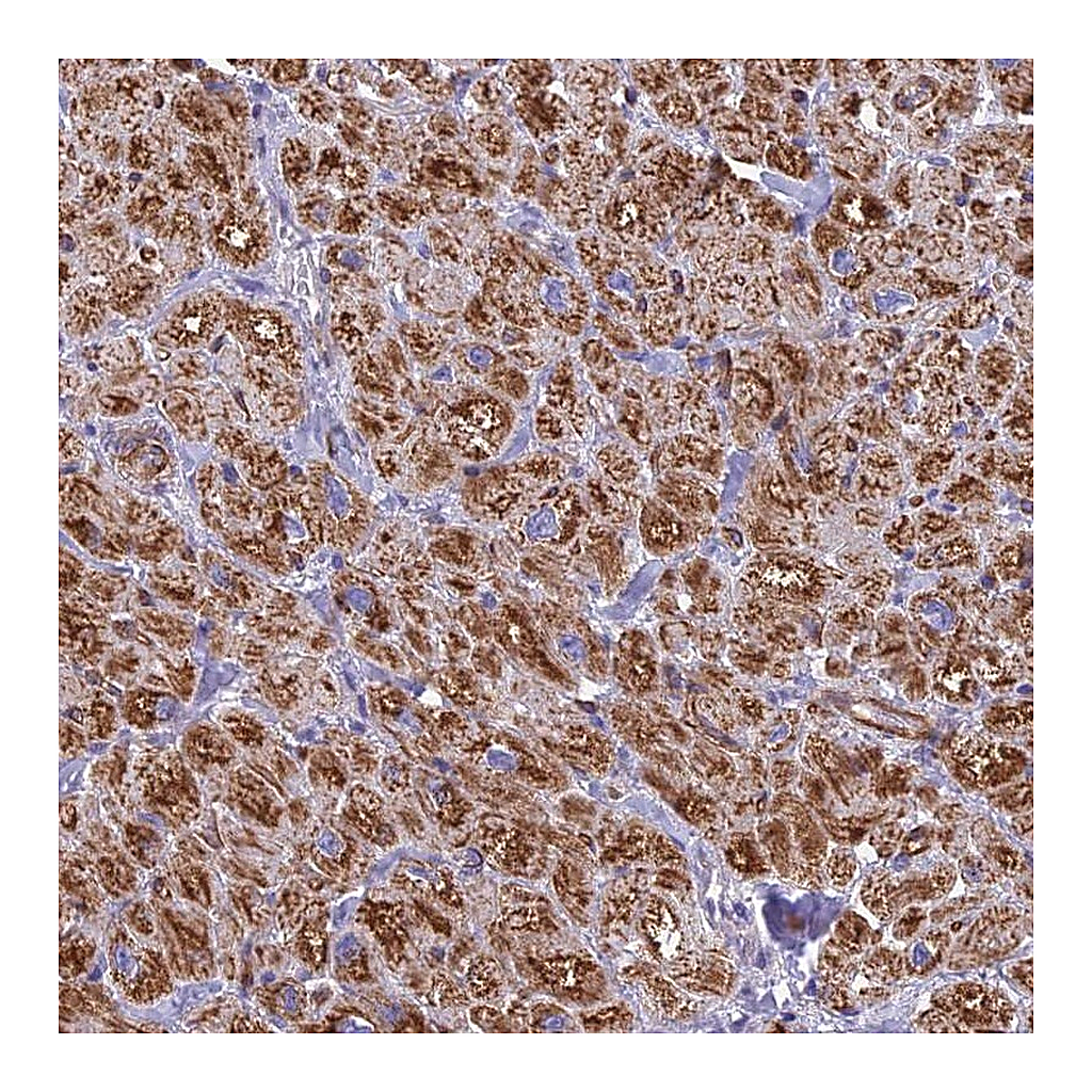 Atlas Antibodies Anti-POMGNT1 Antibody
