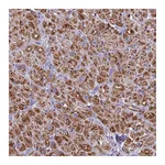 Atlas Antibodies Anti-POMGNT1 Antibody
