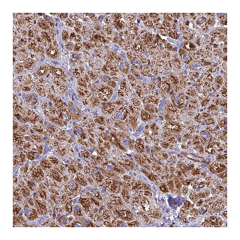 Atlas Antibodies Anti-POMGNT1 Antibody