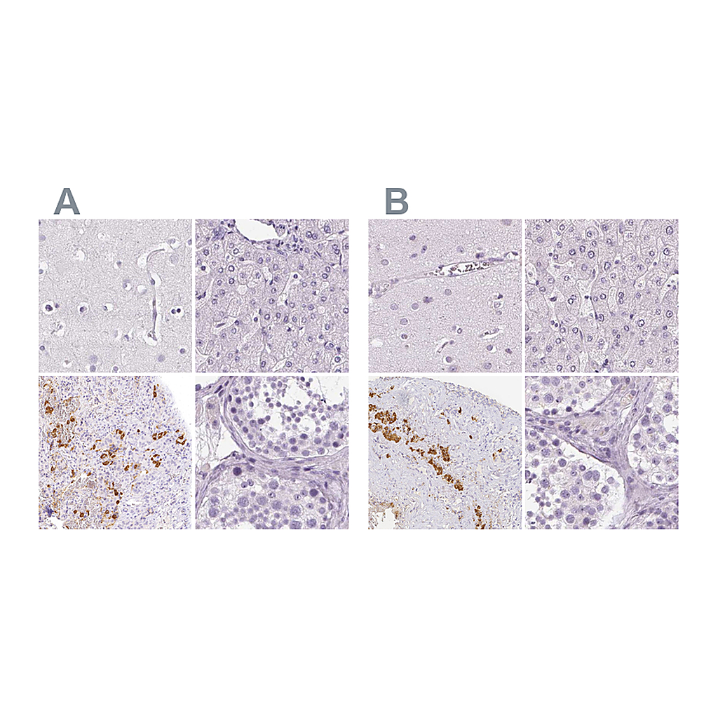 Atlas Antibodies Anti-POMC Antibody