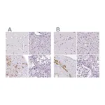 Atlas Antibodies Anti-POMC Antibody